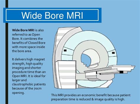 the villages magnetic resonance|MRI: Wide Bore vs Open .